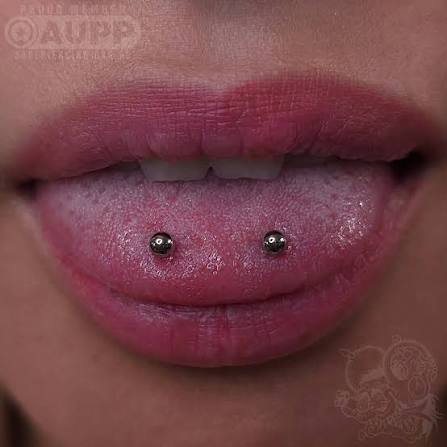 Tongue